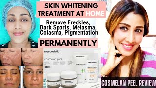 💯Permanent Whiter Skin at home Cosmelan Peel Review Before and After Cosmelan Treatment Lighten Skin [upl. by Nuahsal]