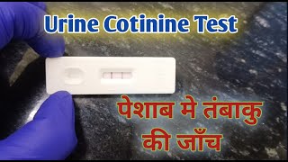 urine cotinine I cotinine urine test I tobacco test [upl. by Allrud]