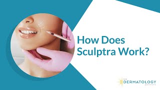 Sculptra Filler Treatment for Facial Volume [upl. by Carce]