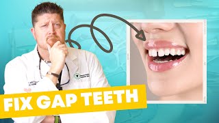 Why You Have GAP TEETH amp How to Fix It [upl. by Clava168]