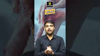 Bacteria is most commonly responsible for the sepsis in the burn patient shorts mukeshsir [upl. by Isbella]