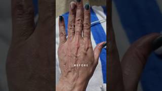 Hands Fascia Blaster Review  Before and After [upl. by Owens439]