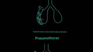 Tactile Fremitus Explained [upl. by Goody]