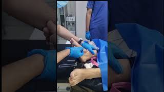 IV canullation how to insert intravenous canulla to vein [upl. by Tella870]