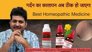 गर्दन का कालापन अब ठीक हो जाएगा  Homeopathic Medicine  Acanthosis nigricans [upl. by Erdah]