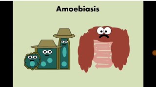 Entamoeba histolytica Amoebiasis الأميبا  الدوسنتاريا [upl. by Attenohs]