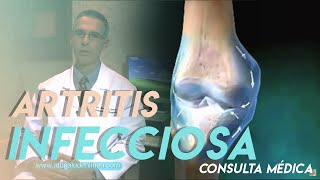 ¿Qué es la artritis infecciosa  Síntomas y Tratamiento [upl. by Zilef]