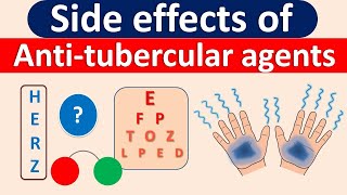 Side effects of AntiTubercular agents in easy way [upl. by Enerual]