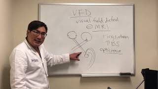 Visual field defects without MRI  structural correlate [upl. by Zednanref]