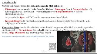 TVT  tiefe Venenthrombosen  Phlebothrombose [upl. by Nivram]