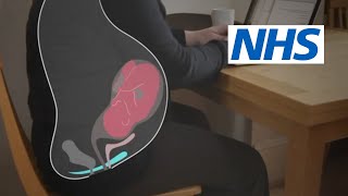 How and when should I do pelvic floor exercises  NHS [upl. by Parfitt845]