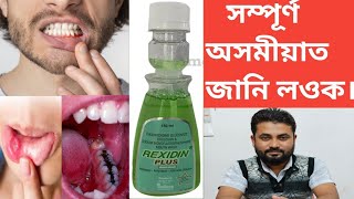 REXIDIN PLUS Mouthwash  Antiseptic  Anticaries Solution [upl. by Ulda76]