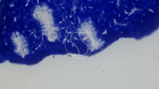 Helicobacter pylori Toluidine Blue Staining [upl. by Fleeman]