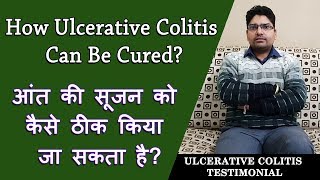 How Ulcerative colitis can be Cured  अल्सरेटिव कोलाइटिस को कैसे ठीक किया जा सकता है [upl. by Anilocin]