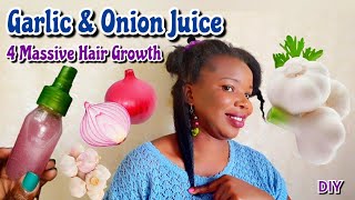 FASTER HAIR GROWTH How to Make amp Use Garlic amp Onion for EXTREME Hair Growth  Lyne amp Beauty [upl. by Oiled]