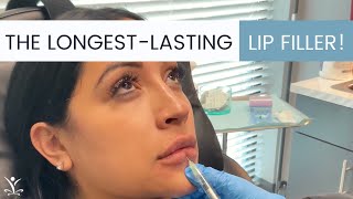 Volbella Lip Injections Can Last Up to a Whole Year [upl. by East]