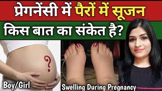 प्रेगनेंसी में सूजन आना किस बात का संकेत देता है कैसे ठीक करें l Swelling During Pregnancy [upl. by Jorgan404]