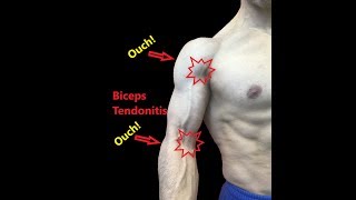 Biceps Tendonitis  Exercises And Myofascial Release [upl. by Birkner]