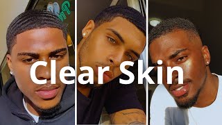 How To Get Clear Skin Naturally [upl. by Etnoved933]