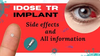 Eyes on the Future Exploring the Wonders of iDose TR in Glaucoma Management [upl. by Enaek]