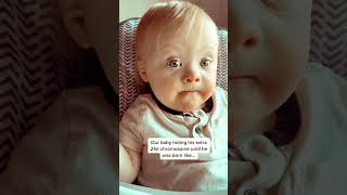 👶A Miracle Baby With Extra 21st Chromosome downsyndrome downsyndromeawareness [upl. by Perice]