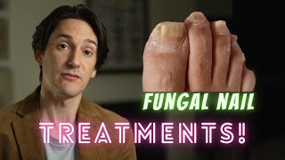 Fungal Nail Treatments [upl. by Olwena]