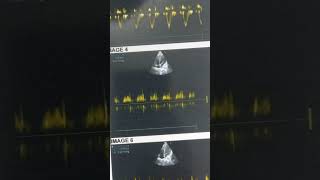 Echocardiography [upl. by Regor]