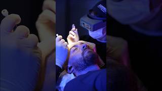 Cosmedica Clinic Hair Transplant in Turkey shorts hairtransplant video [upl. by Gant]