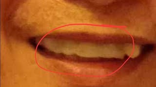 How to make fake tooth to repair your teeth using moldable tooth [upl. by Ayomat806]