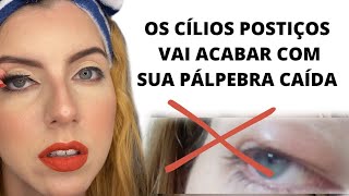 COMO CORRIGIR PTOSE SEM CIRURGIA😱ESSA DICA É INCRÍVELptosepalpebral cirurgiadaspalpebras [upl. by Ancalin997]