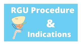 RGU procedure amp its indication [upl. by Bores]