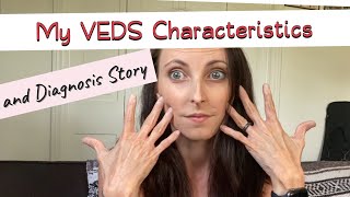 My VEDS Characteristics and Diagnosis Story Vascular EhlersDanlos syndrome [upl. by Oinotla791]