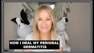 PERIORAL DERMATITIS  HOW I TREAT MY SKIN FLARE UPS [upl. by Reggis]