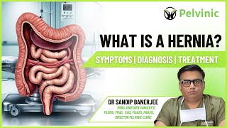 हर्निया क्या है  What is Hernia Explained in Hindi  Symptoms amp Treatment of Hernia [upl. by Adim]