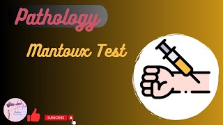 Mantoux Test [upl. by Ztnarf]