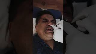 Cranial Facial Release CFR for Nasal Obstruction  Sleep Apnea [upl. by Llohcin]