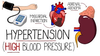 Hypertension Explained High Blood Pressure  Includes Hypertensive Emergency amp NICE Guidelines [upl. by Deehsar]