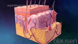 Skin Cancer and Melanoma Animation [upl. by Denyse330]