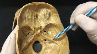 Skull Osteology  Cranial Cavity Anatomy [upl. by Hagi]