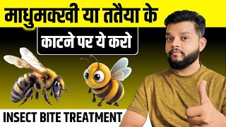 Insect Bite Treatment In Hindi  Bee amp Wasp Bite Treatment At Home [upl. by Willabella]