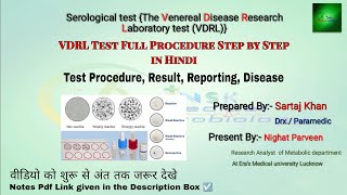 vdrl test principal and full procedure  Vdrl disease serological test in laboratory  vdrl test mlt [upl. by Inram]