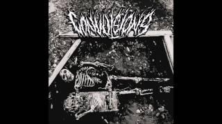 Convulsions  ST EP 2016 Full Album HQ Grindcore [upl. by Royo404]