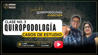 Quiropodologia casos de estudio 3 [upl. by Anama84]