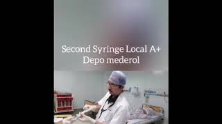 EPIDURAL INJECTION TECHNIQUE [upl. by Nbi]