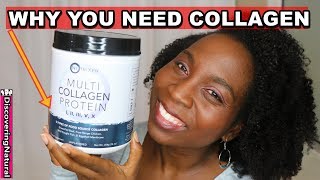 Collagen for Healthy Hair Skin and Nail Growth  DIY Protein Treatment [upl. by Lehcin]