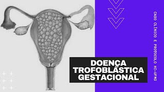 Doença Trofoblástica Gestacional [upl. by Alvan]