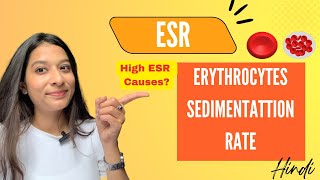 ESR  Erythrocytes Sedimentation Rate  Factors affecting ESR  Clinical Significance  Hindi [upl. by Mandal]