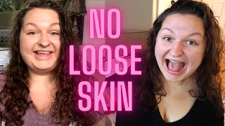 How To Avoid Loose Skin  40 Pound Weight Loss  Before and After [upl. by Yeloc797]