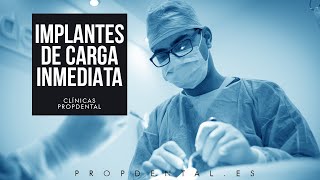 Cirugía de la colocación de implantes carga inmediata [upl. by Mushro727]