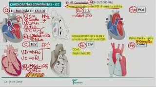 21 PEDIATRIA  CARDIOPATIAS CONGENITAS  QX MEDIC 2021 [upl. by Aisiram]